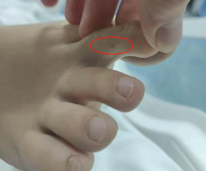 星空体育：“三亚旅游被不明物咬伤身亡27岁女子”死亡记录：曾诊断为不明生物咬伤(神经毒蛇) 等(图2)